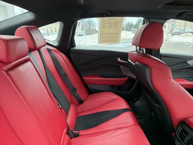 2025 Acura TLX A-SPEC Package