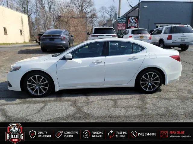 2017 Acura TLX w/Technology Package