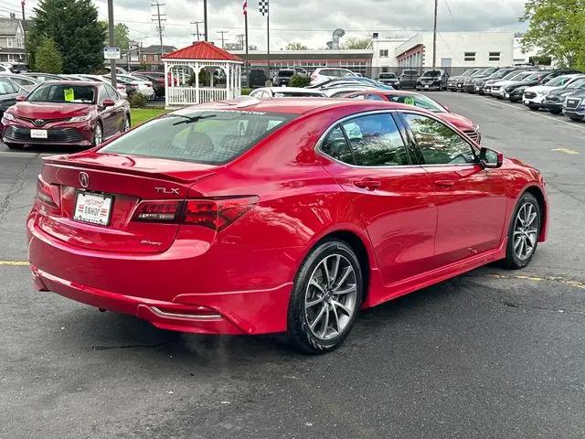 2017 Acura TLX w/Technology Package
