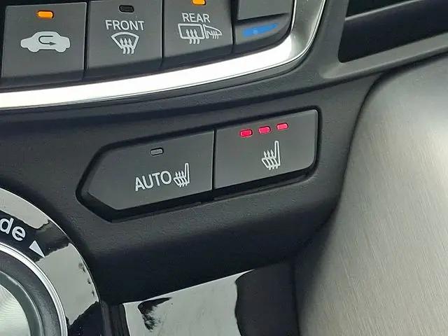 2025 Acura TLX Technology Package