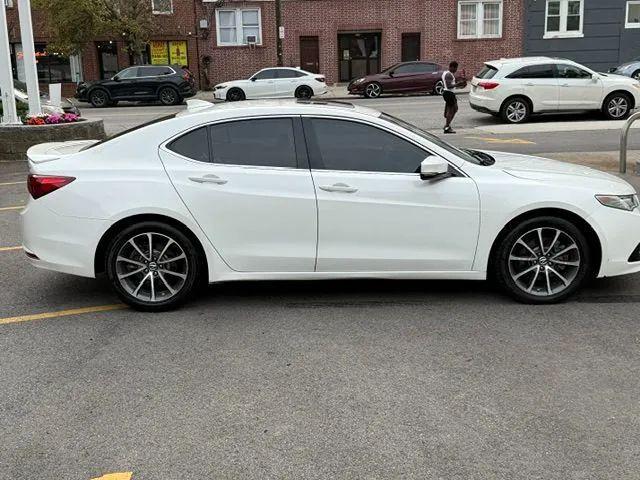 2015 Acura TLX V6 Advance